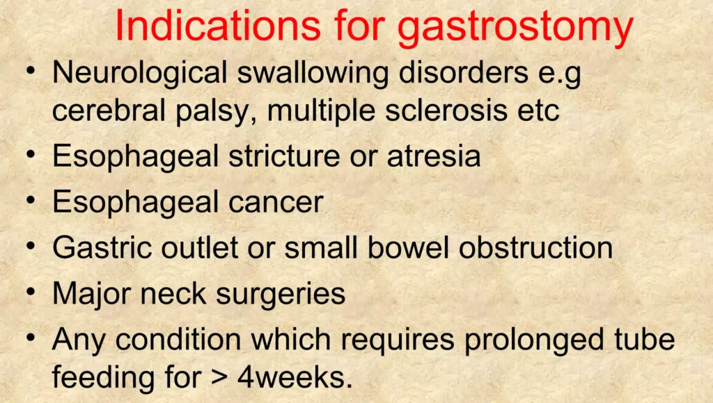 Indications of Gastrostomy feeding