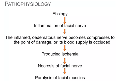 Pathophysiology of Bell’s Palsy