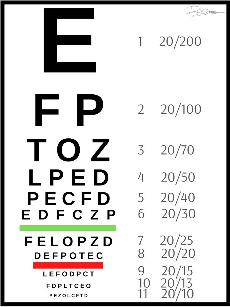 Snellen Chart