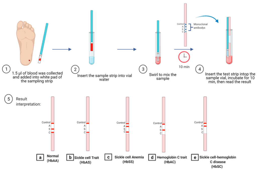 Diagnosis and Investigations sickle (2) (1)