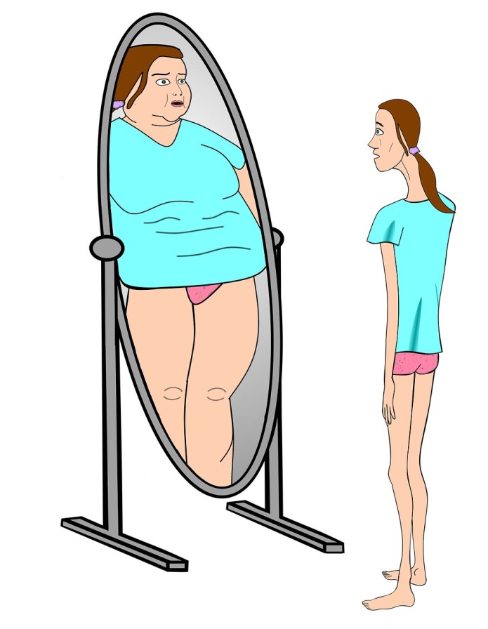 eating disorders anorexia nervosa