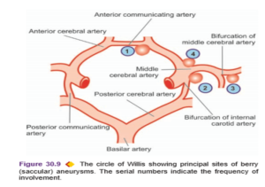 Intracranial Hemorrhage - Nurses Revision