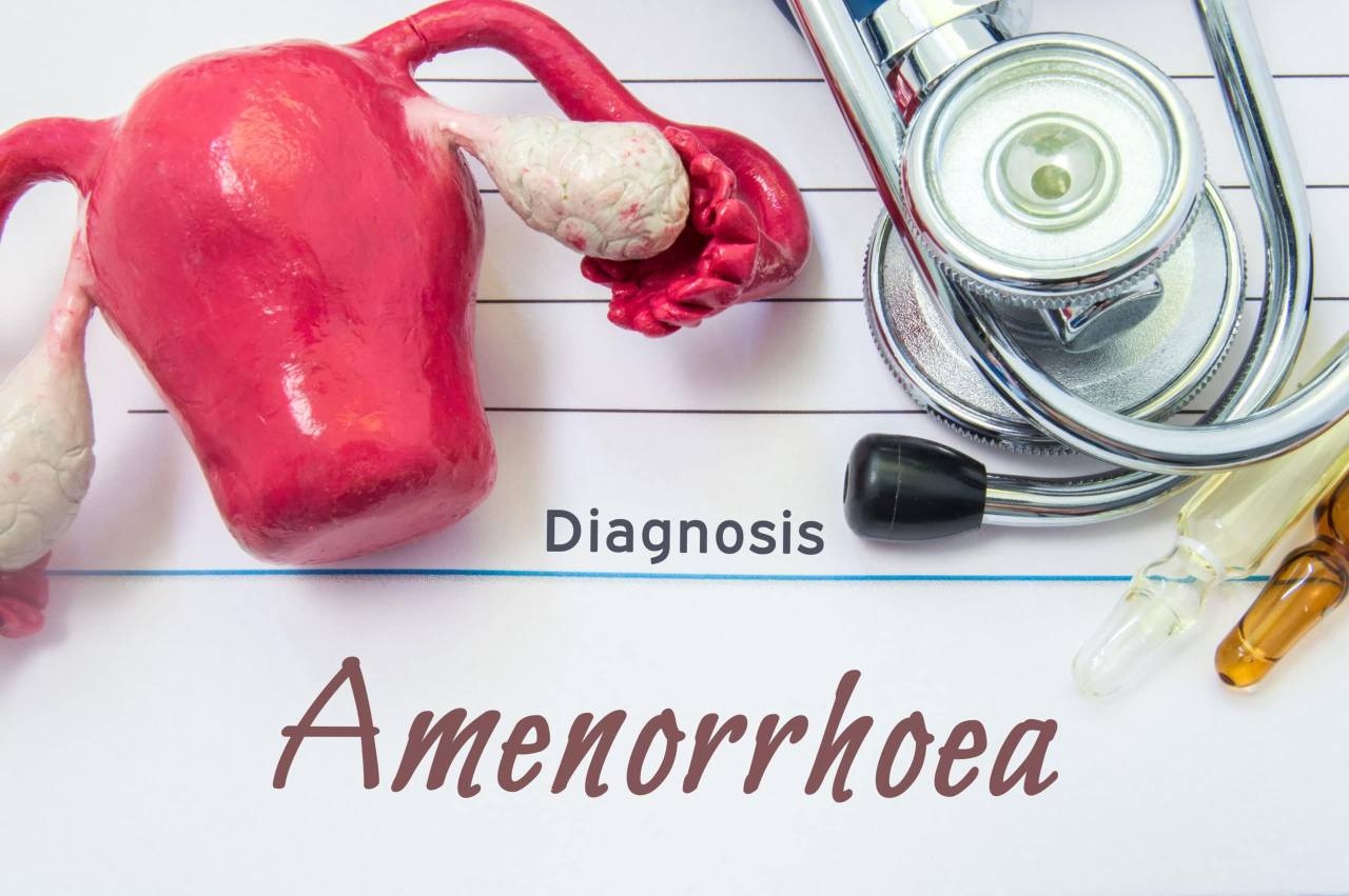 AMENORRHOEA