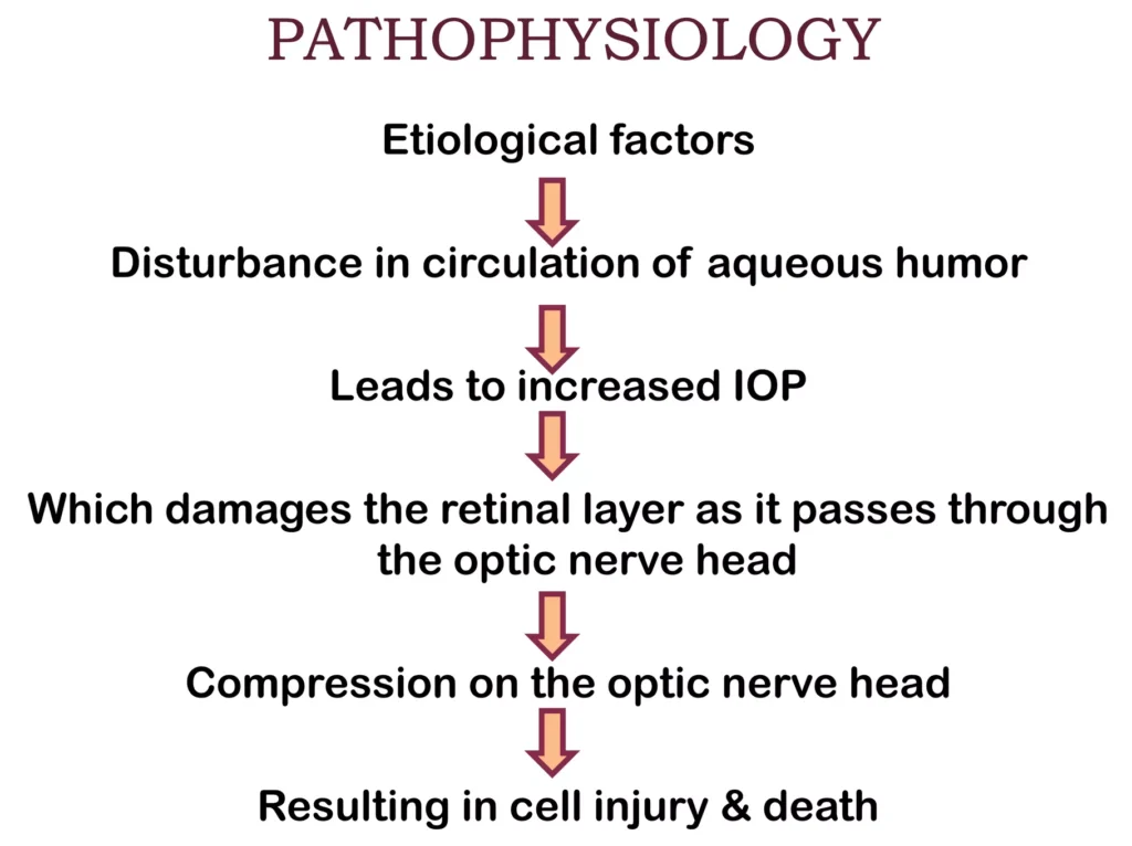 Pathophysiology of Glaucoma