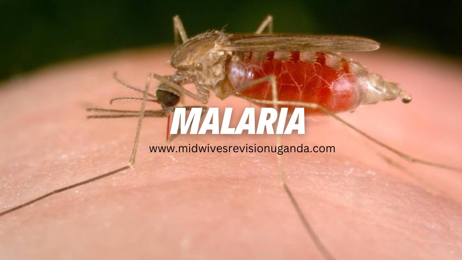 Malaria