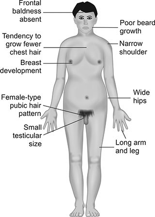 signs of intersex