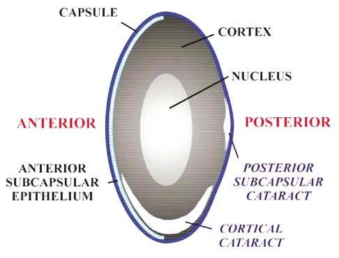 Lens Anatomy Cataract