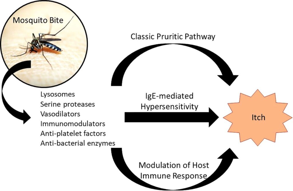 Pathophysiology of Insect Stings and Bites: