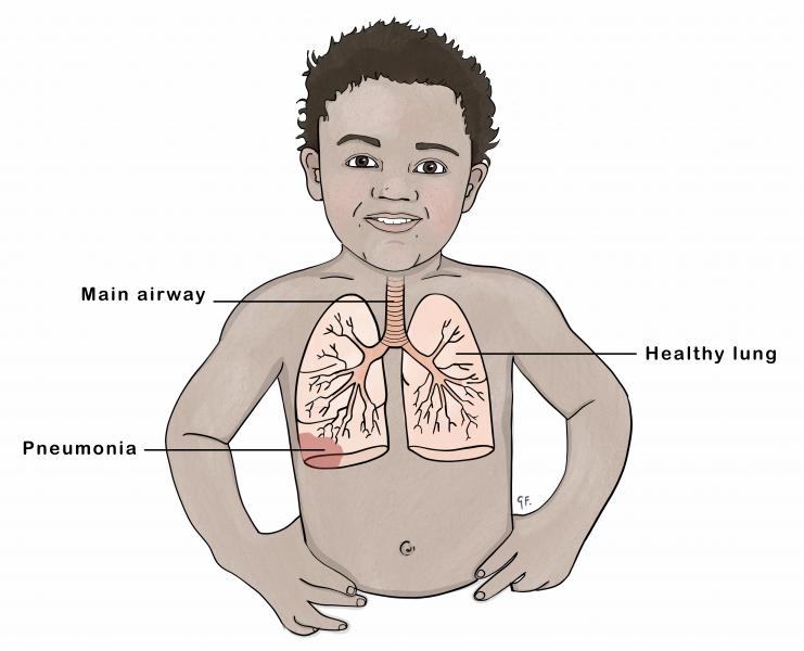 Pediatrics Nurses Revision Pediatrics Nurses Revision