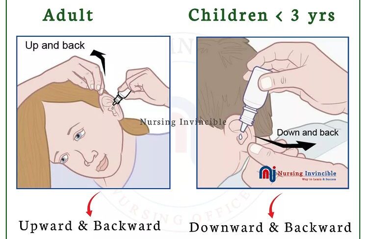 INSTILLING MEDICATION IN THE EAR