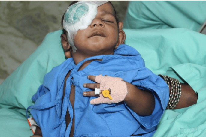 Care of a child under going eye surgery (1)