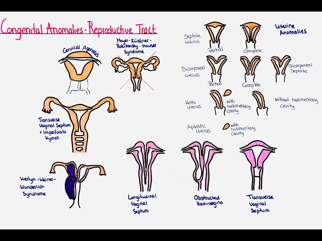 Congenital abnormalities of the reproductive organs