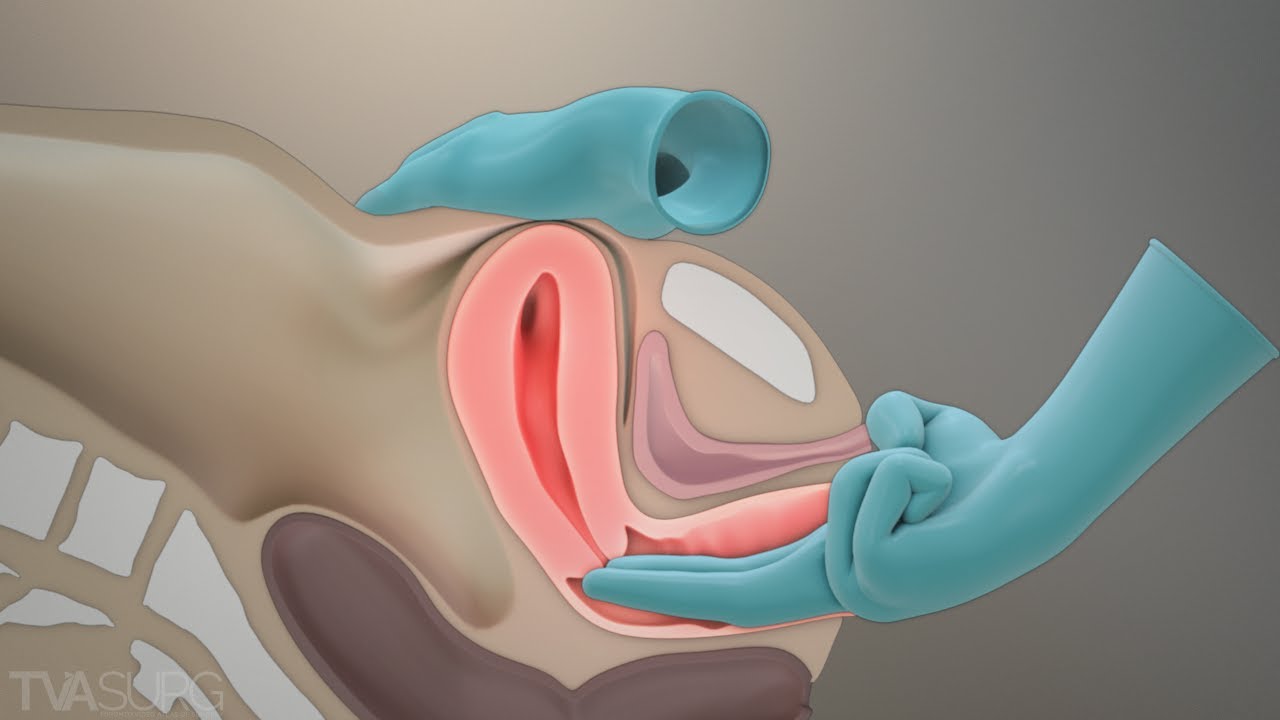 PELVIC ASSESSMENT