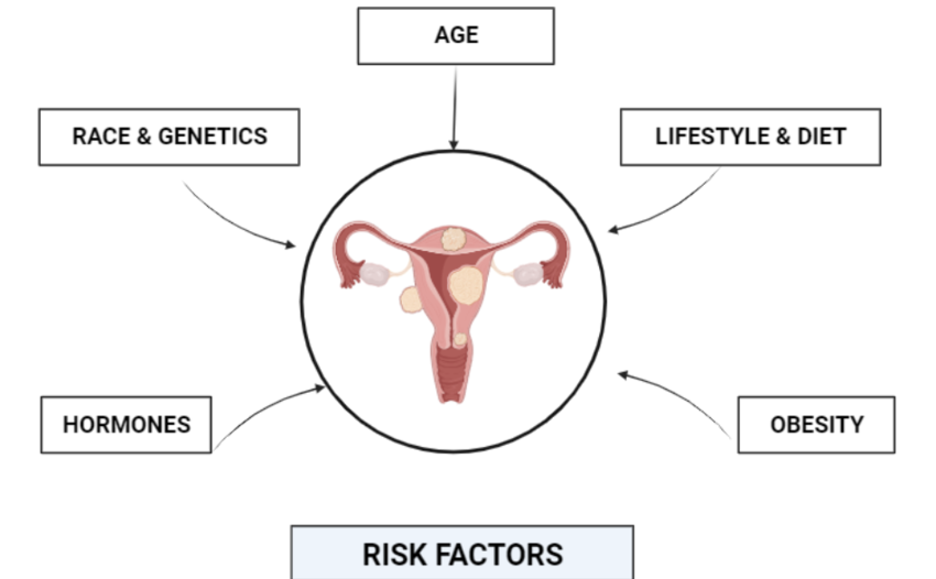 Risk factors for uterine fibroids