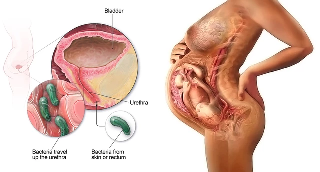 Significance of female urinary system in obstetrics