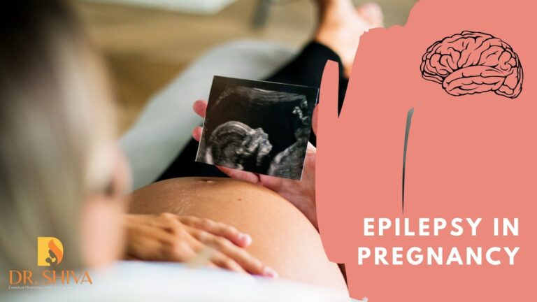 EPILEPSY IN PREGNANCY