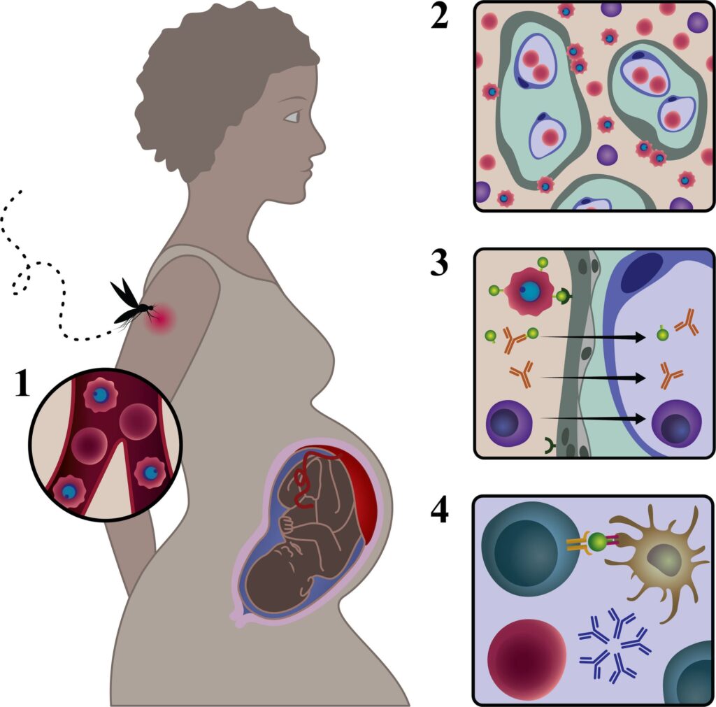 MALARIA IN PREGNANCY