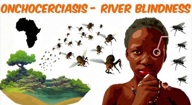 Onchocerciasis (River blindness)