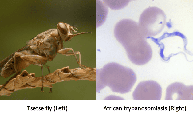 Trypanosomiasis (sleeping sickness)