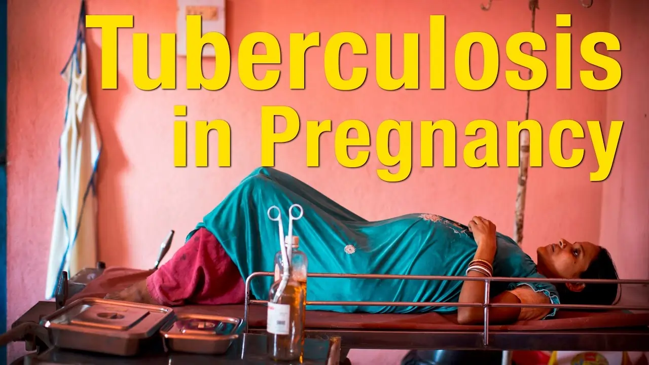 Tuberculosis in Pregnancy