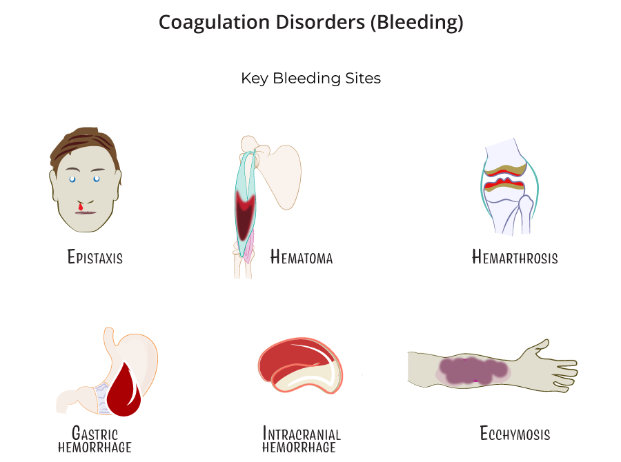 COAGULATION DISORDERS