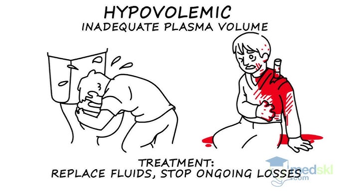 Surgical Shock