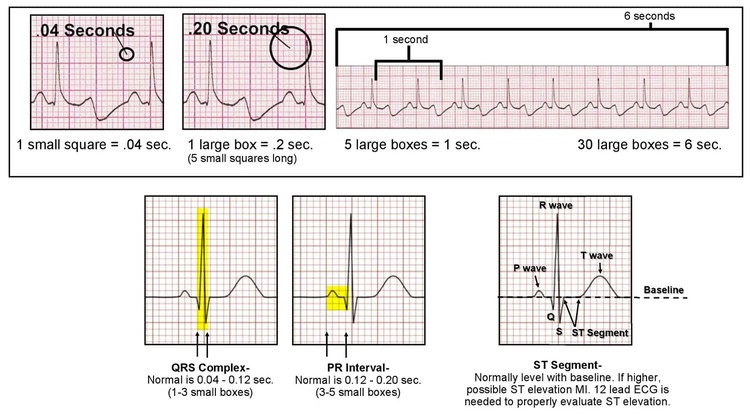 ELECTROCARDIOGRAM INTERPRETATION