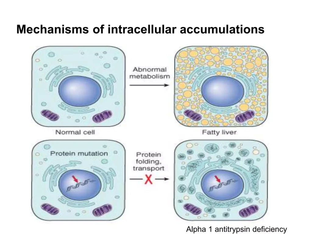 intracellular accumulation