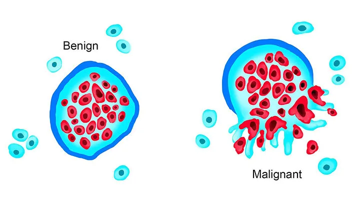 Neoplasia & Oncology
