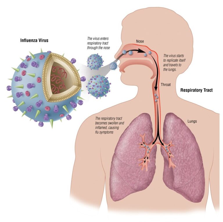 Upper Respiratory Tract Infections (URTIs)