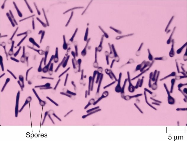 Clostridia and Gram-Positive Anaerobic Cocci