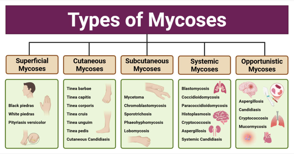 Dermatophytosis and Other Superficial Mycoses