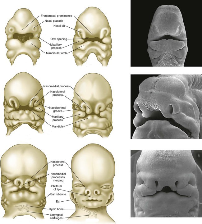 Embryology of the Nose Diagrams