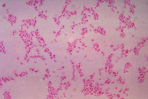 Gram-Negative Anaerobic Rods (GNAR)
