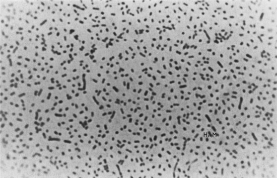 Haemophilus, Pasteurella & Francisella