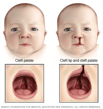 Embryology Face Development Diagrams