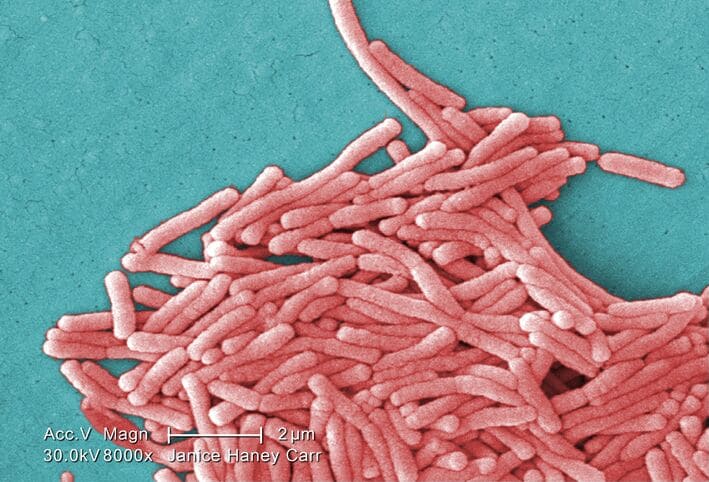 Legionella pneumophila