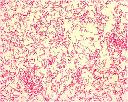 Miscellaneous Fastidious Gram-Negative Rods (HACEK Group & Capnocytophaga)
