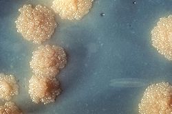 Mycobacterium tuberculosis Complex