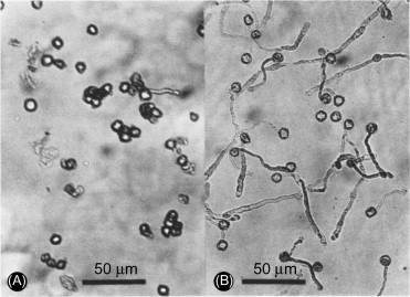 Mycoplasmatales