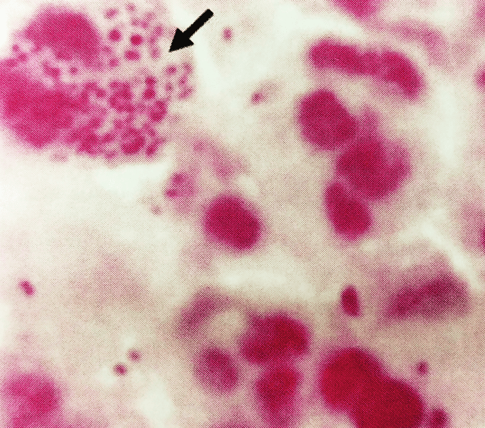 Neisseria and Moraxella (1)