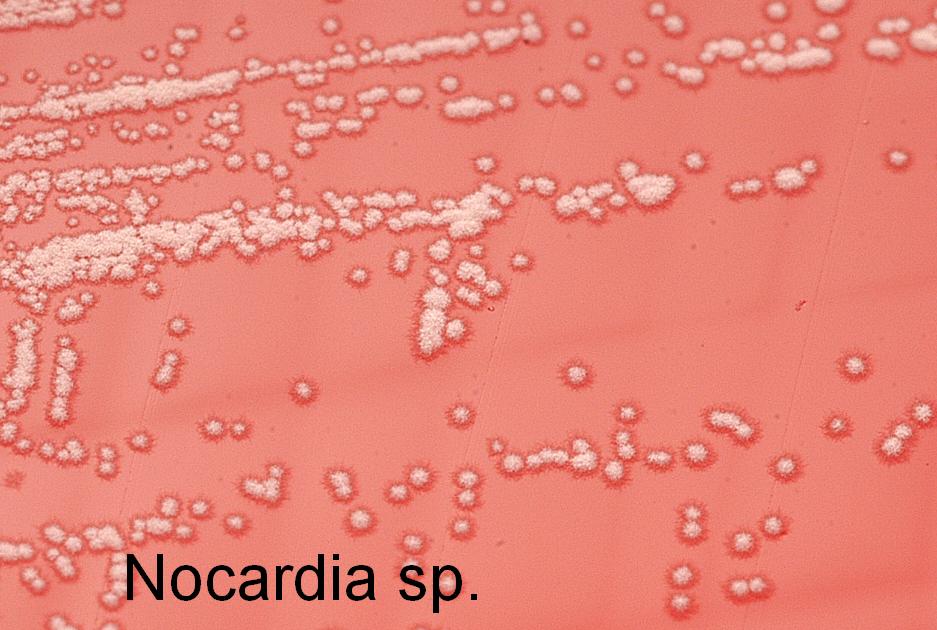 Nocardia Species - Nurses Revision