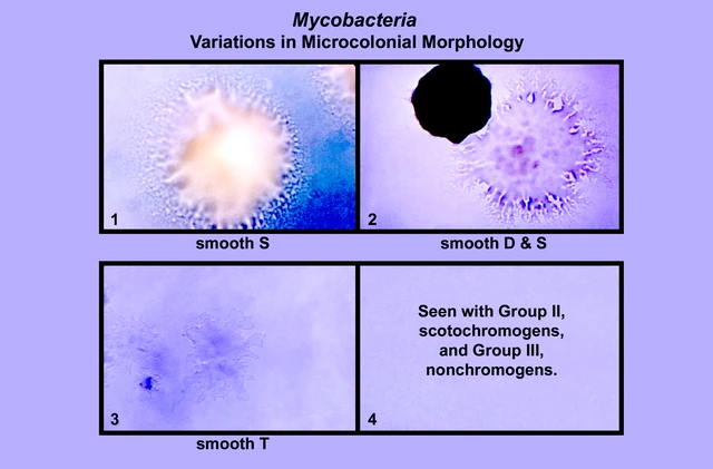Non-Tuberculous Mycobacteria (NTM)