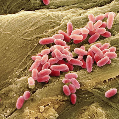 Pseudomonas & Non-Fermentative Gram-Negative Rods