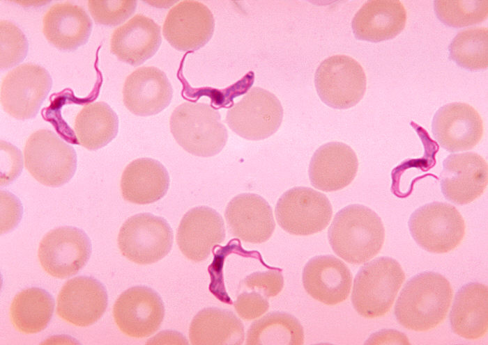 Trypanosomiasis