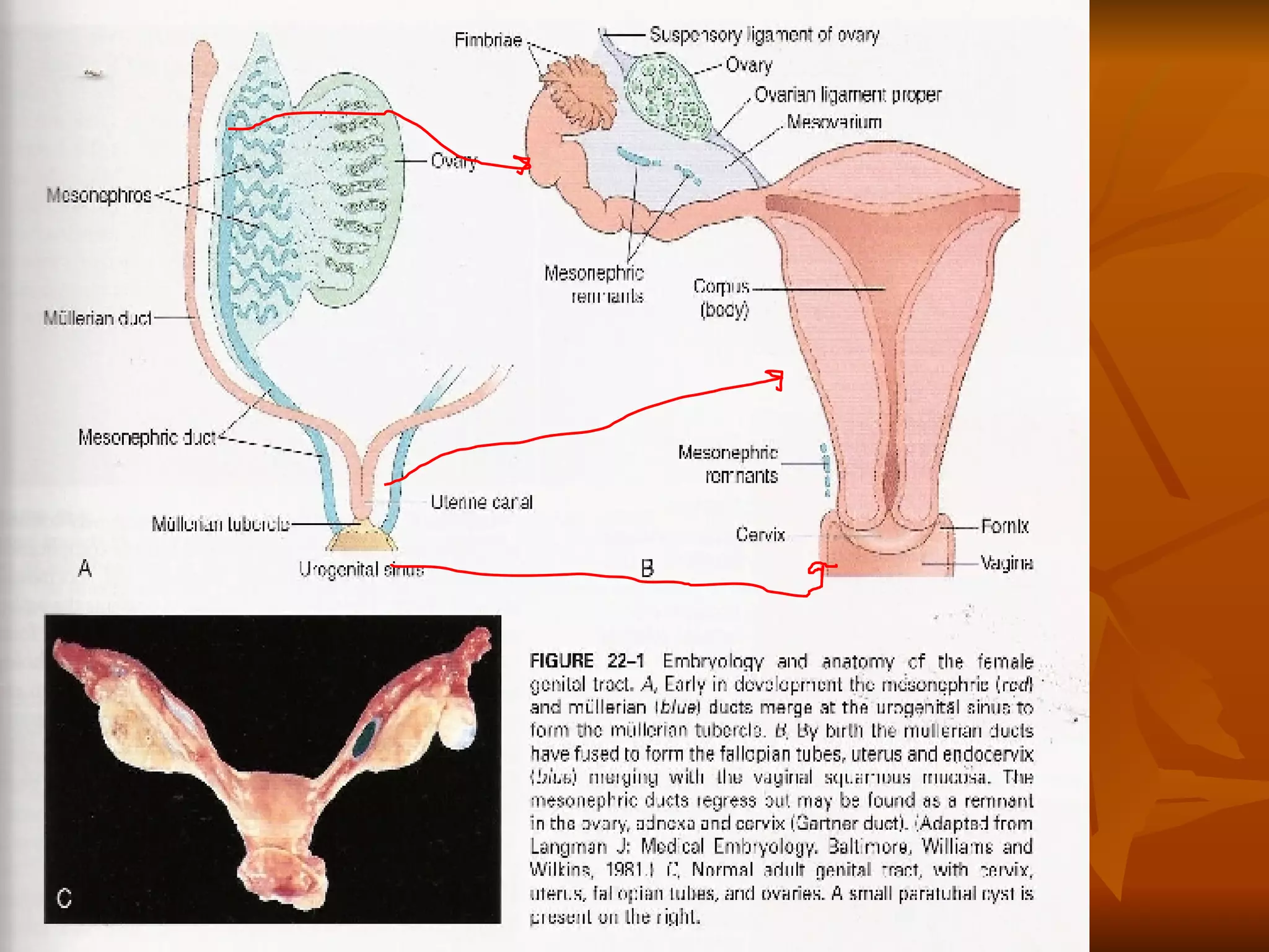 Pathology of the Female Genital Tract
