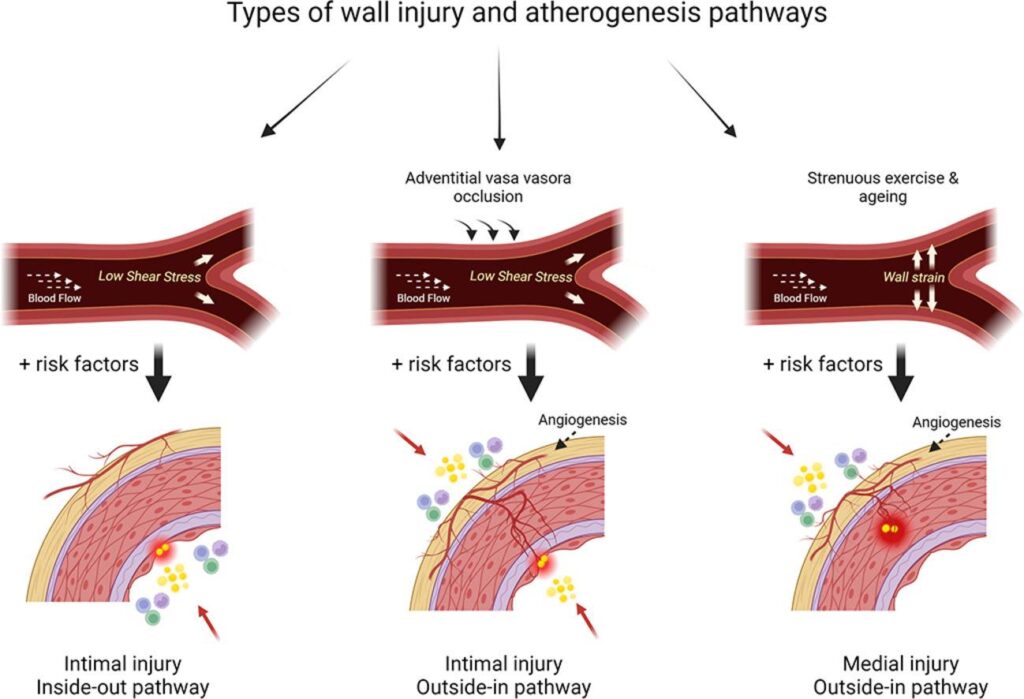 Pathology of the Vascular Wall Response to Injury